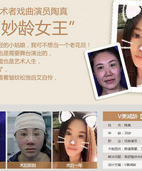 穆宝安面部提升——面部除皱的注意事项有哪些