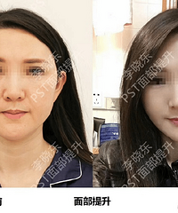 Ƥ���ɳڻᵼ����Щ�仯?����������Ϊ��ҽ���