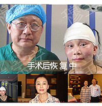 穆宝安:V美减龄为达完美每日2台手术堪称限量版技术