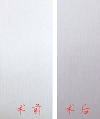 成都吸脂减肥,整形医生刘晶科普吸脂手术过程