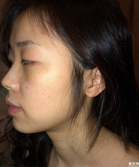 第一次打水光针的感觉竟是这样?像嘴里咬了花椒