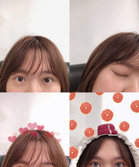 做双眼皮前后的我,完全就是两个人,不信你来看