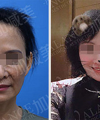 穆宝安V美减龄让你的皮肤回到十年前