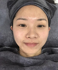 让皮肤瞬间回到婴儿肌,我只用了这种方法