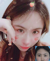 �ɶ��ֵ�Ԩ¡�ǣ��ǲ�����ҽ���ֵ�Ԩ