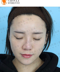 有在贾德渊那里做过鼻子的吗