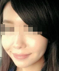 成都牙齿矫正哪里好?