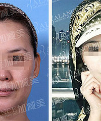 穆宝安V美减龄远离衰老魔咒