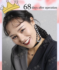 �ɶ���Ů����¡�ǣ��Ƽ��ֵ�Ԩҽ��