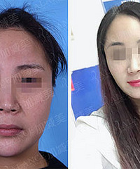 穆宝安怎么样,V美减龄回到青春时代