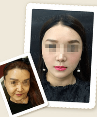 穆宝安:V美减龄稳坐冠军宝座 超越传统提升项目二十年