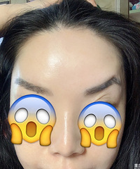 用了这个方法,我抬头纹完?#32769;?#22833;,现在拍照都不用美颜相机