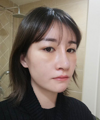 鼓足勇气做了全面部自体脂肪填充,现在2个月了,说实话有点后悔