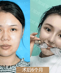 黄寅守:如何拥有一个时代美鼻
