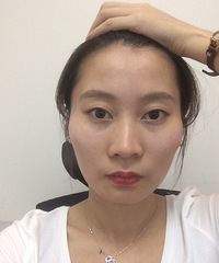 走出社会第一步,做个面部脂肪填充+双眼皮!+【美莱变美日记】