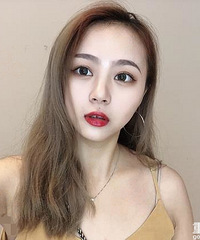 我的双眼皮做得太自然!连朋友都没看出我割过,来看对比效果吧