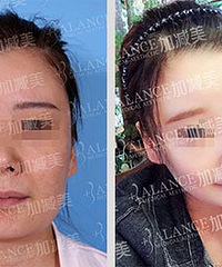 穆宝安:V美减龄1个小时打造少女秀容