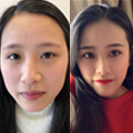 整容级别的“纹眉术”