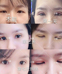 20����������ۣ�������Ҳ��ԲԲ�ġ����۾�+�����������ռǡ�