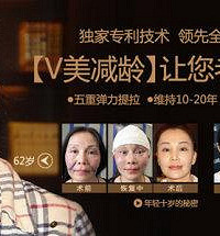 V美减龄面部提升好不好,超越传统提升技术30年