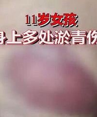 нʦ11ŮͯϣѧУ˵ǲǰ