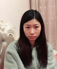 天生肿泡眼和内双,做了双眼皮和祛眼袋,朋友说看起年轻好几岁