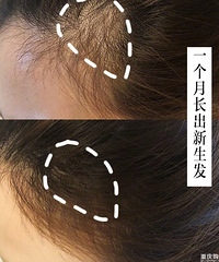 护发沙龙搬回家!生姜加食疗防脱发护发,亲测有用