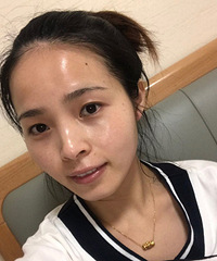 晒素颜照说出皮肤问题,能免费体验抗衰老和眼部小熨斗项目哟