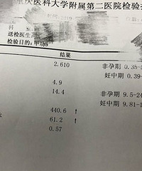 浅谈近1年多看过的内分泌科医生,这几位好医生推荐给你们