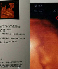 听说四维彩超单上的这一串数据暗示着宝宝的性别,是真的吗?
