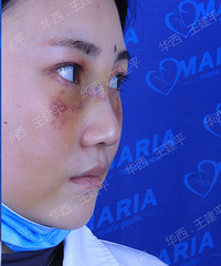 �ɶ�¡������ã��������ۺ������ɾ��ҵĲ���ɱ