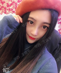 成都隆鼻手术,不取肋软骨,如何做出肋软骨鼻综合的效果