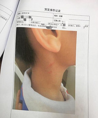 һСѧҳȰ˶ද֢ѧУֽЭ