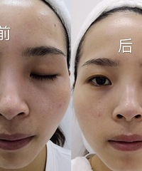 �������������ݻ�����Ƥ�������ø��ã���һ�ξ�����������Ч��