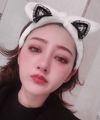 做了隆鼻和双眼皮,朋友说我气质都不一样了