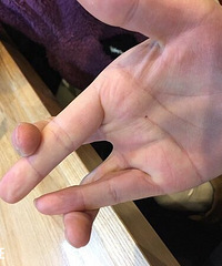 ������������ƣ��������ľ���