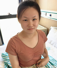 我做的双眼皮不仅自然还没什么痕迹,90天后变这样