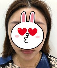 �ײ���ҽ����Ƶ������ڼ�����Ƶ�ǵ�����һ�ξ�������������