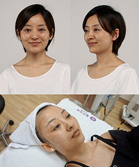 华美6月超值团购!去黑小棕瓶3180、祛眼袋2999、综合隆鼻6800