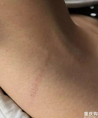 女子面馆用餐遭老板抓伤