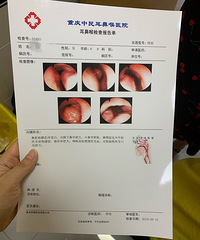 Ȱ��ҹ�עһ�����ӵ�����仯����Ҫ����������������ʴ��ջ���