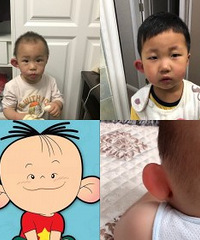 被蚊子咬成了大耳朵图图