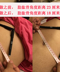 徒手产后整体修复限时开团