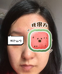 美白是终生事业!做完这个之后,皮肤暗沉松弛完全改善