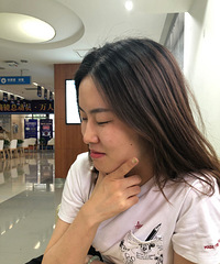 近视眼手术第二天就能正常用眼,全程轻松无痛感