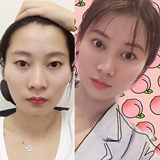 这个方法让脸变饱满了