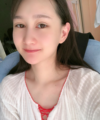双眼皮太窄看起来显老,加宽后,眼部线条自然好看