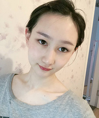双眼皮太窄看起来显老,加宽后,眼部线条自然好看