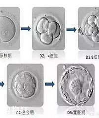 �Թ�Ӥ���У����ߡ��䶳�ߡ�������������ֲ���ֽϺã�