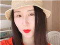 舒畅直播疑似整容过度